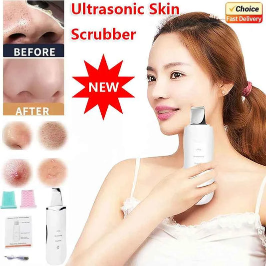 âGlow Surgeâ Ultrasonic Skin Scrubber + EMS Microcurrent Wand