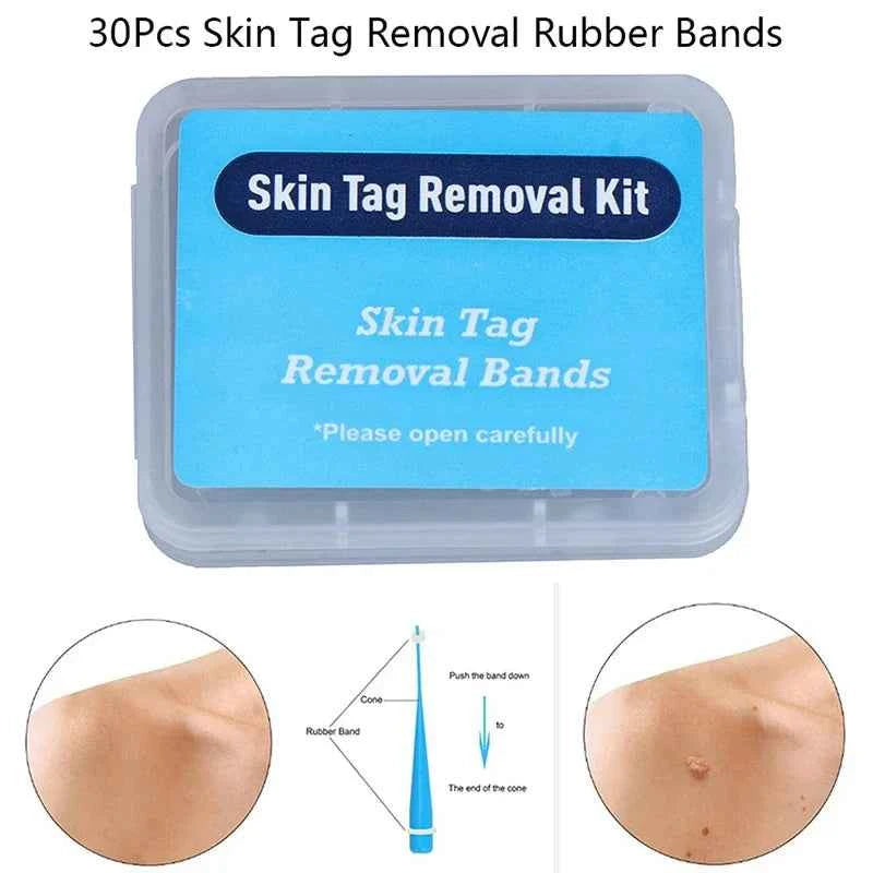 30pcs/pack Skin Tag Removal Rubber Bands Micro Band Non Toxic Face Care Mole Wart Skin Care Tools
